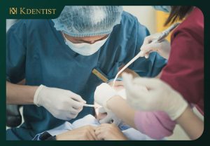 Dịch vụ điều trị tủy răng Quảng Ngãi KDENTIST