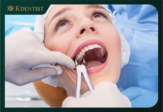 Dịch vụ nhổ răng tại nha khoa Quảng Ngãi