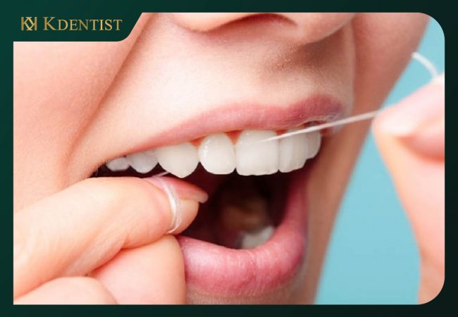 Hướng dẫn cách chăm sóc răng implant sau khi niềng răng
